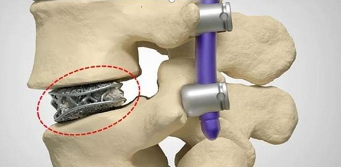 Application Story | Cat walks again thanks to 3D-printed Titanium Prosthetic Limbs Application Story | Cat walks again thanks to 3D-printed Titanium Prosthetic Limbs
