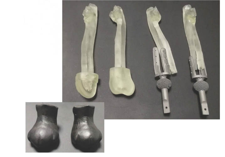 What Metal Material is More Suitable for Implants Printing?