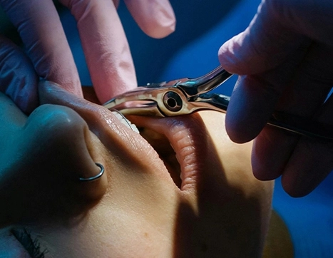 Additive Manufacturing Machine in Healthcare